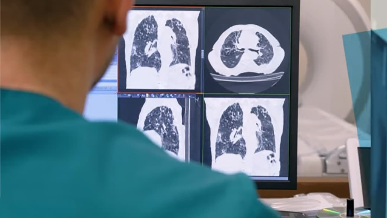 Median Technologies décroche le feu vert de la FDA et s’envole en Bourse