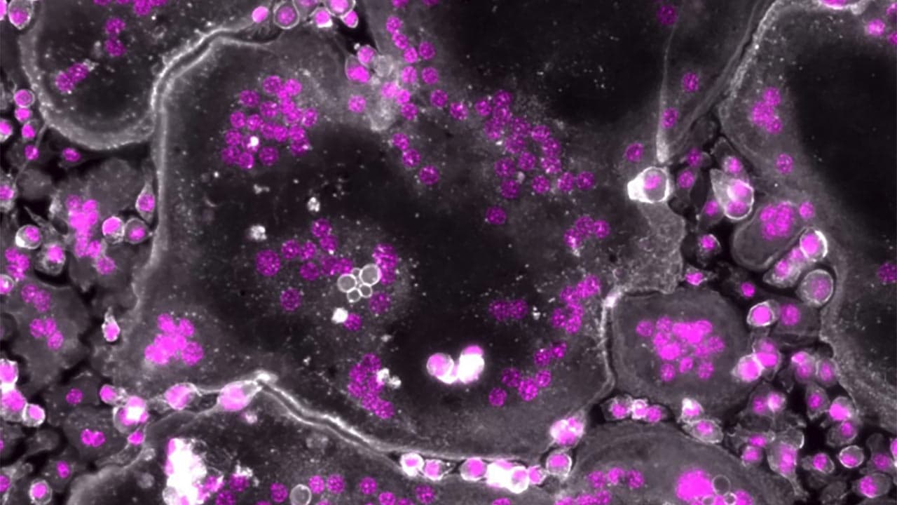 Recherche : une découverte majeure sur les cellules du squelette