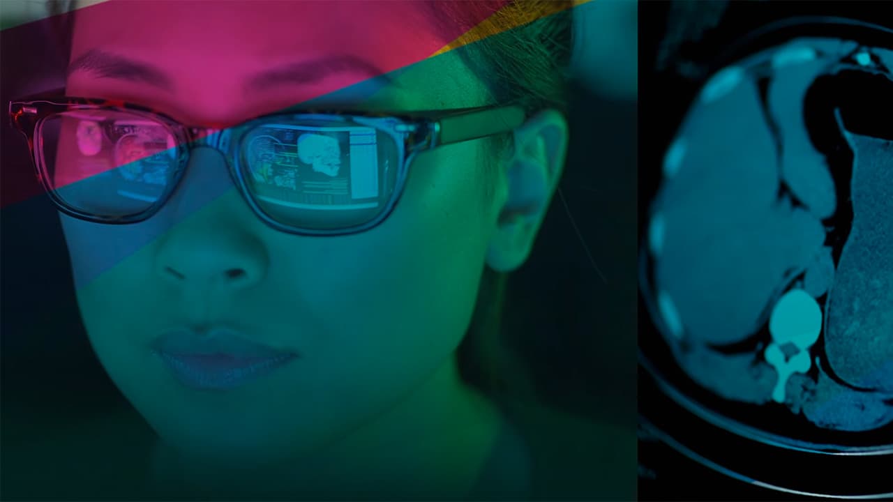 Sophia : une troisième année record pour Median Technologies