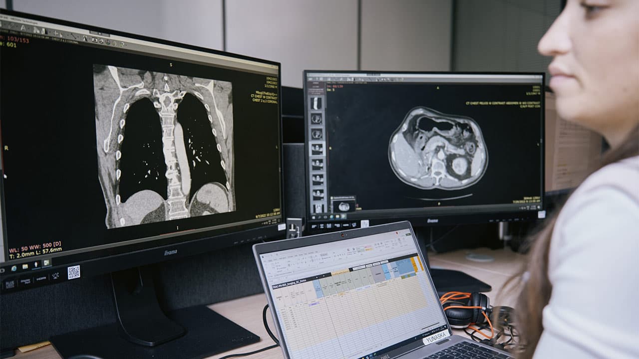 Median lève plus de 40 M€ pour le dépistage précoce du cancer